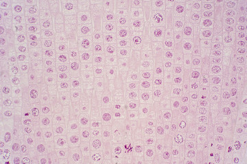 Root tip of Onion show Mitosis cell in the Root tip under microscope view.