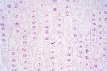 Root tip of Onion show Mitosis cell in the Root tip under microscope view.