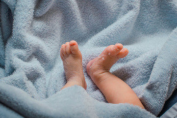Piel escamosa en los pies del bebé recién nacido. Los primeros días de vida después del...