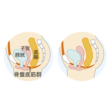 骨盤底筋 Images Browse Stock Photos Vectors And Video Adobe Stock