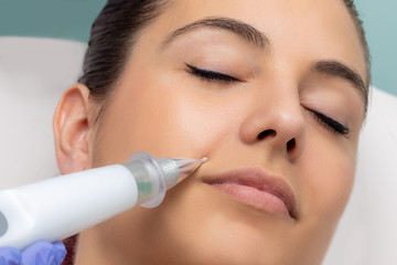 Woman having cheek wrinkles removed with cosmetic plasma laser pen.