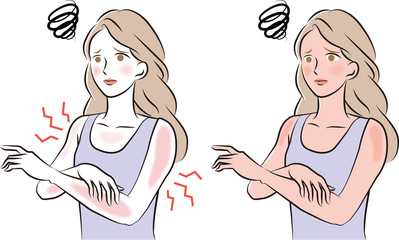 日焼けを気にする女性　イラスト