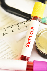 Blood sample tube contain with stem cell