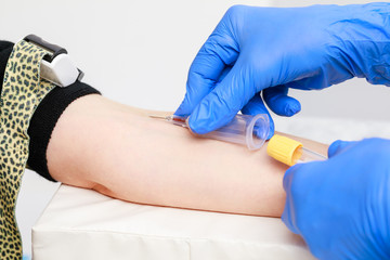 Nurse takes a blood sample from arm vein performing a venipuncture