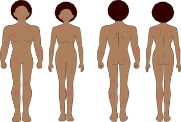 化膿　全身　男女セット