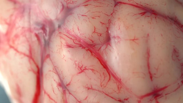 Brain with blood and bloody  veins on the metal stainless steel table plate. Slime germs horror movie effect background, prop for Halloween.  Extreme close up.