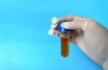 Naklejka premium Hand with white glove with a laboratory sample on blue background. medical concept