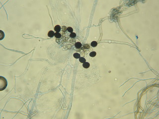 Nigrospora sp.
