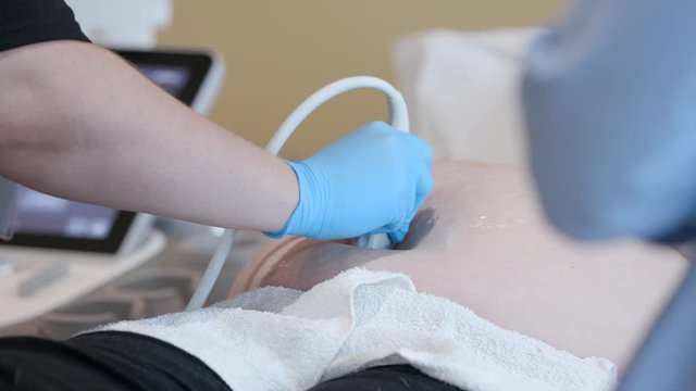 CU Sonographer scanning pregnant woman
