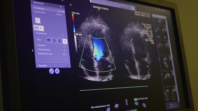 Equipamiento de diagn&oacute;stico y pruebas m&eacute;dicas