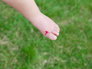 the child injured his leg. The girl provides first aid to her child. The girl injured her leg. A...