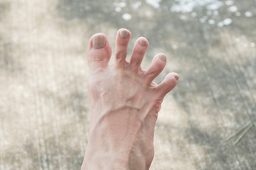 手のように開いた足指