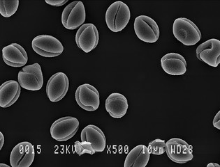 Lesser celandine pollen under electron microscope