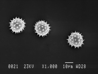 Daisy pollen under electron microscope