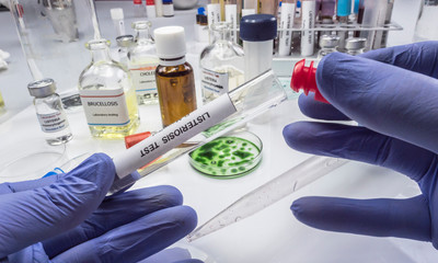 Expert analyzes stuffed meat contaminated by bacterium of listeria in laboratory, sprout caused in Spain