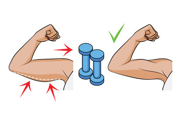 Color vector illustration of a problem of overweight in women. Female hands side view. Body fat on female triceps. Before and after dumbbell exercises
