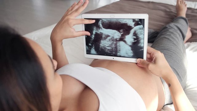 Beautiful young pregnant woman looking ultrasound of her baby on digital tablet while lying on bed.