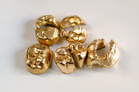 Gold-Recycling: Aufgeflexte Gold-Kronen (Zahngold)
