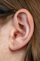 Close up of an infected ear with a shallow depth of field