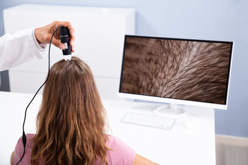 Dermatologist Using Trichoscope For Hair Fall Treatment - obrazy, fototapety, plakaty