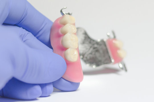 partial denture of the upper jaw in the hands of a dentist
