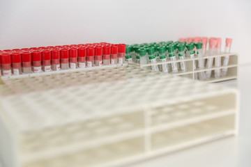 Test tubes on a tube rack.  Medical tools