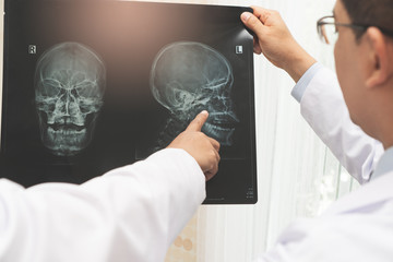 expertise doctor planning treatment for medical concept. Two asian doctor looking at film x-ray head of patient and discussing surgery plan for cure disease.