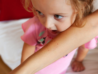 Toddler female biting the arm of the mother.