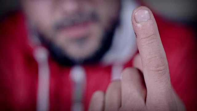 4k Close-up Shot of Man Finger with a Wound