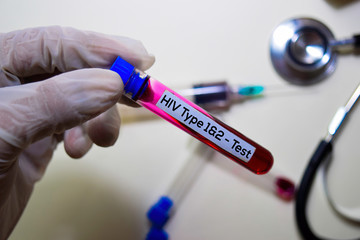 HIV Type 1 & 2 - Test with blood sample. Top view isolated on office desk. Healthcare/Medical concept