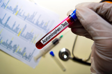 Fototapeta premium Acetaminophen - Test with blood sample. Top view isolated on office desk. Healthcare/Medical concept