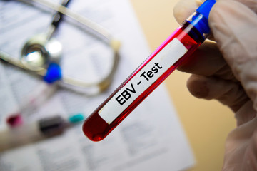 EBV - Test with blood sample. Top view isolated on office desk. Healthcare/Medical concept