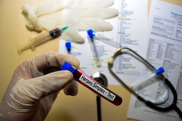 Herpes Simplex - Test with blood sample. Top view isolated on office desk. Healthcare/Medical concept