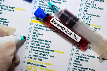 Reticulocyte Count - Test with blood sample. Top view isolated on office desk. Healthcare/Medical concept