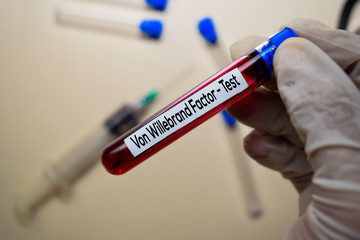 Obraz premium Von Willebrand Factor - Test with blood sample. Top view isolated on office desk. Healthcare/Medical concept