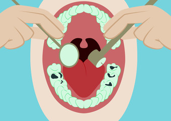 Vector illustration in flat design oral cavity and dental instruments