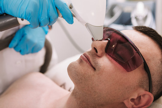 Cropped close up of a young man removing hair on his nose at beauty salon.  Professional cosmetologist using laser hair removal device on her male  client Stock Photo | Adobe Stock