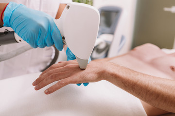 Cropped shot of a cosmetologist removing hair on the hand of a male client, using laser hair...