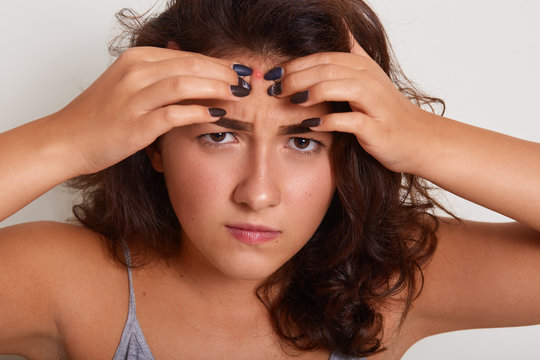 Close up portrait of young woman squeezing pimple on her forehead while standing over white studio background, attractive darkhaired female having problems with facial skin. Skincare concept.