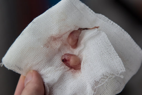 cat balls after castration in hand
