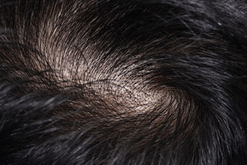 Close-up on Asian Woman Black Hair and Scalp