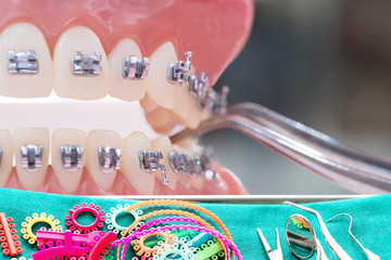 Close up dentist tools and orthodontic model  - demonstration teeth model of varities of...