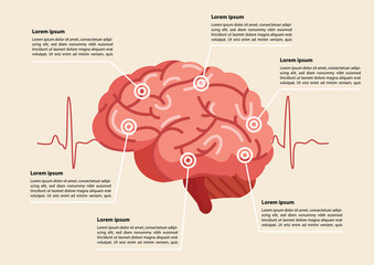 Human brain stroke illustration.