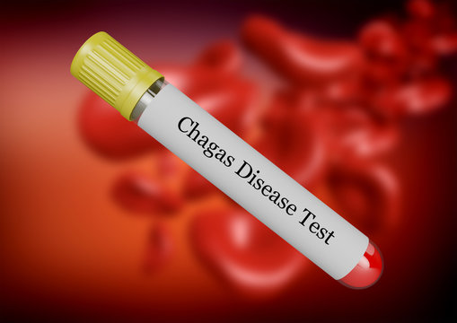 Test nasturtium disease in blood collected in test tube isolated by selective focus