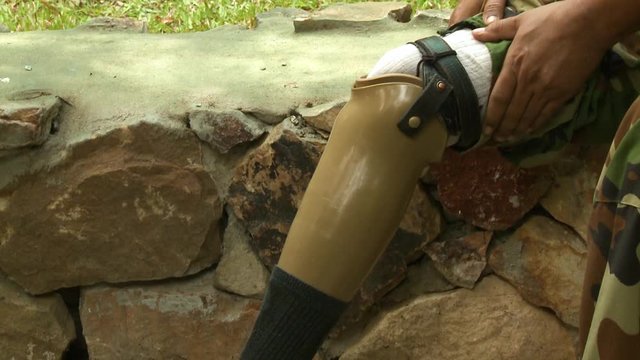 A medium closeup shot of an army soldier veteran amputee as he pulls his camouflage pants and shows off his plastic prosthetic leg wearing a black sock and matching black leather shoe at the Cambodia
