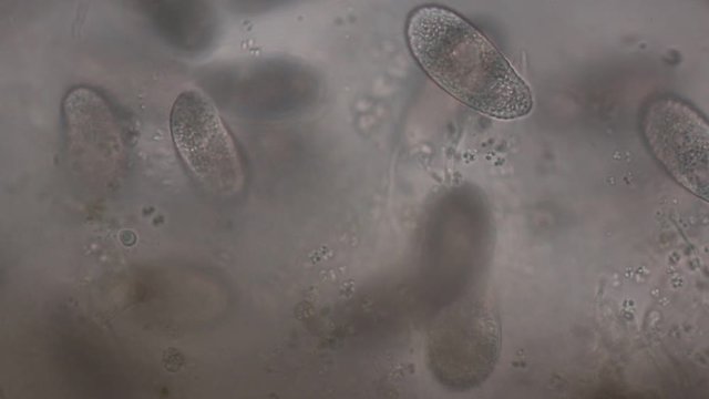 Paramecium caudatum is a genus of unicellular ciliated protozoan and Bacterium under the microscope.