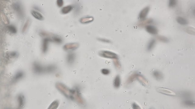 Paramecium caudatum is a genus of unicellular ciliated protozoan and Bacterium under the microscope.