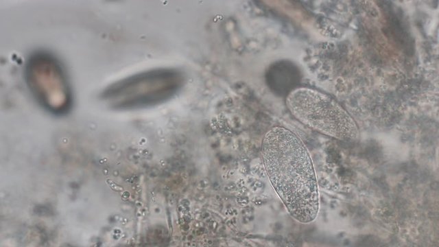 Paramecium caudatum is a genus of unicellular ciliated protozoan and Bacterium under the microscope.