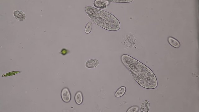 Paramecium caudatum is a genus of unicellular ciliated protozoan and Bacterium under the microscope.