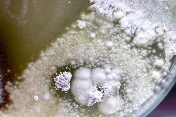 Backgrounds of Characteristics and Different shaped Colony of Bacteria and Mold growing on agar plates from Soil samples for education in Microbiology laboratory.